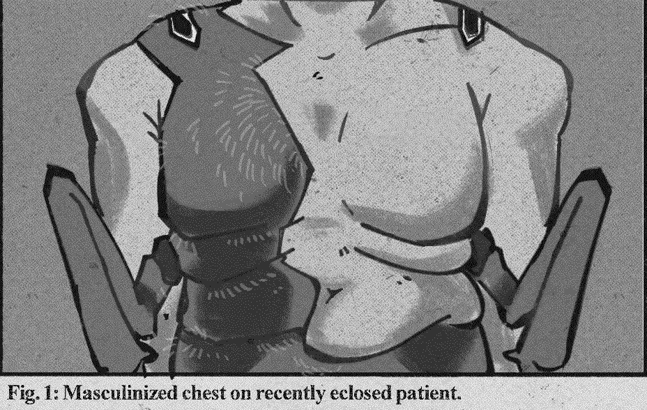 A photo from a study called Induced Gynandromorphism During Metamorphosis To Treat Gender Dysporia in Fairies. It displays the bare chest of Jason Hoang.